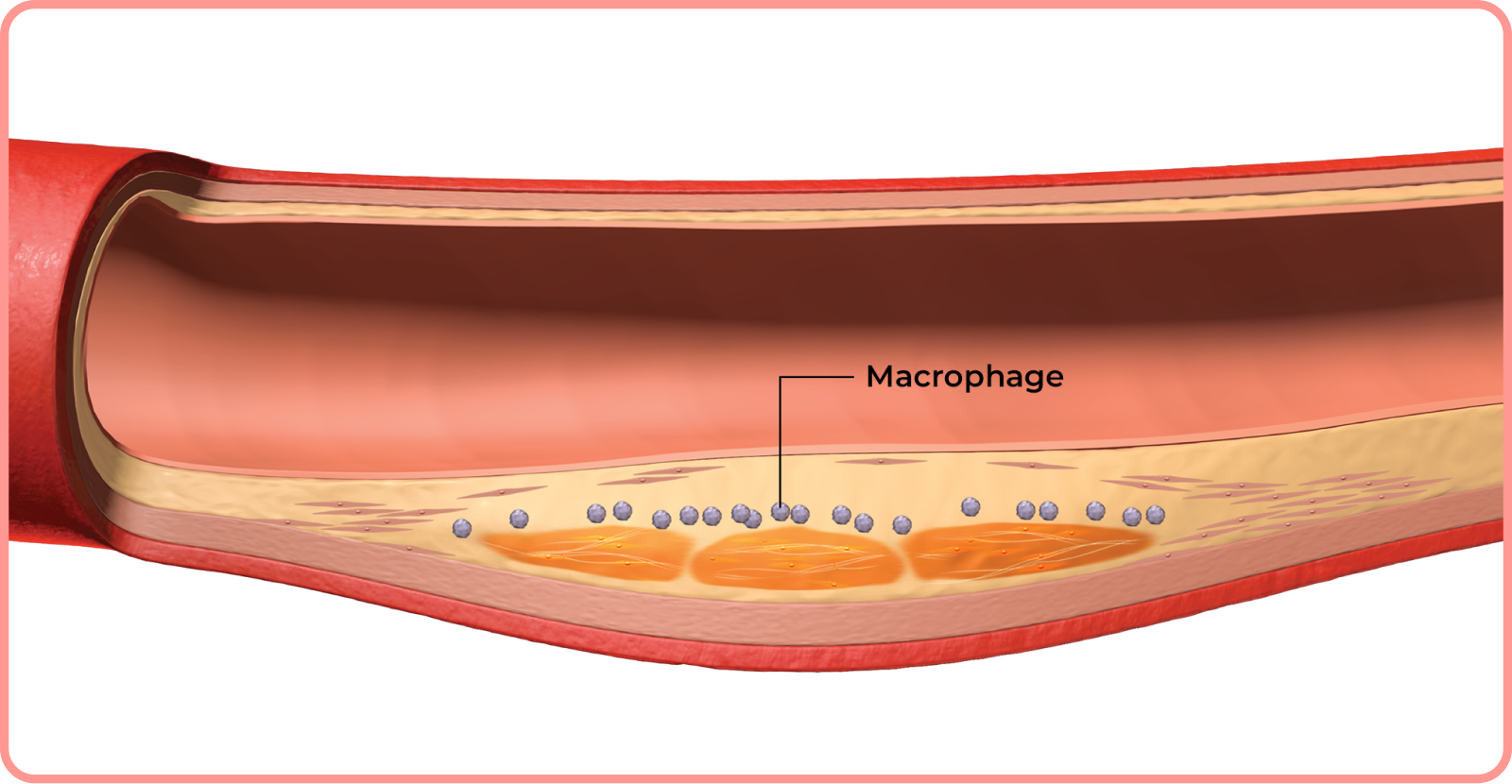 interactive artery: macrophage in artery